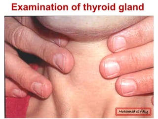 Examination of thyroid gland
Mohamed el fiky
 