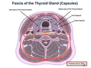 Right Lobe of The Thyroid GlandLeft Lobe of The Thyroid Gland
Isthmus
True Capsule
False Capsule
Fascia of the Thyroid Gland (Capsules)
Mohamed el fiky
 