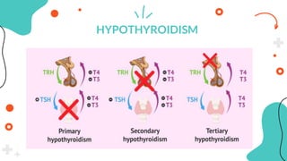 THYROID GLAND.pptx