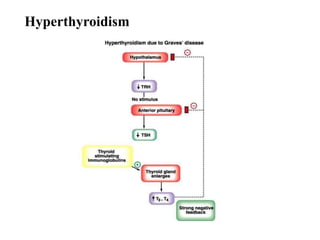 Hyperthyroidism
 