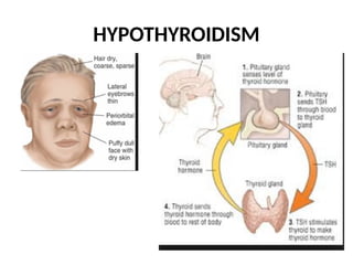Thyroid gland. Endocrine system of human | PPTX