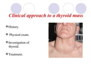 History.
 Physical exam.
Investigation of
thyroid.
Treatment.
 