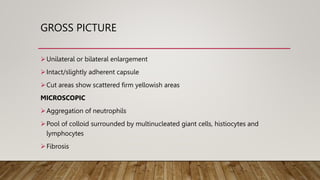 GROSS PICTURE
Unilateral or bilateral enlargement
Intact/slightly adherent capsule
Cut areas show scattered firm yellowish areas
MICROSCOPIC
Aggregation of neutrophils
Pool of colloid surrounded by multinucleated giant cells, histiocytes and
lymphocytes
Fibrosis
 