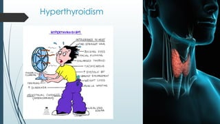 Hyperthyroidism
 