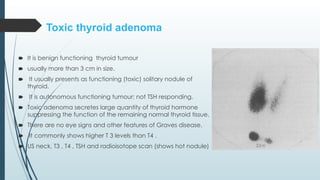 Toxic thyroid adenoma
🠶 It is benign functioning thyroid tumour
🠶 usually more than 3 cm in size.
🠶 It usually presents as functioning (toxic) solitary nodule of
thyroid.
🠶 It is autonomous functioning tumour; not TSH responding.
🠶 Toxic adenoma secretes large quantity of thyroid hormone
suppressing the function of the remaining normal thyroid tissue.
🠶 There are no eye signs and other features of Graves disease.
🠶 It commonly shows higher T 3 levels than T4 .
🠶 US neck, T3 , T4 , TSH and radioisotope scan (shows hot nodule)
 