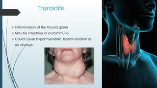 Thyroiditis
❖ Inflammation of the thyroid gland
❖ May be infectious or autoimmune
❖ Could cause hyperthyroidism, hypothyroidism or
no change.
 