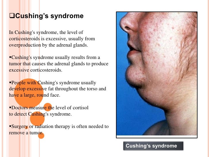 Thyroid gland,Adrenal gland and Gonads