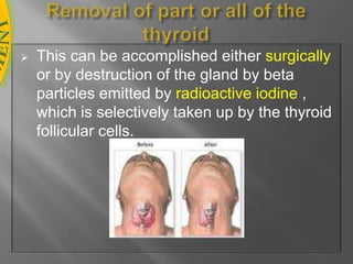 Endocrine disorders: Therapy in patients with concomitant diabetes mellitus, diabetes insipidusor adrenal insufficiency (Addison's disease) exacerbates intensity of their symptoms. Levothyroxin cautionsMyxedema coma: Patients are particularly sensitive to thyroid preparations. Sudden administration of large doses is not without cardiovascular risks and may cause myxedema coma. so, small initial doses are indicated.Therapy of myxedemacoma requires simultaneous administration of glucocorticoids. Levothyroxin cautionsCardiovascular disease : Use caution when integrity of cardiovascular system, particularly coronary arteries, is suspect (eg, angina, elderly). Development of chest pain or worsening cardiovascular disease requires decrease in dosage. 