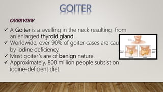  A Goiter is a swelling in the neck resulting from
an enlarged thyroid gland.
 Worldwide, over 90% of goiter cases are caused
by iodine deficiency.
 Most goiter’s are of benign nature.
 Approximately, 800 million people subsist on
iodine-deficient diet.
 