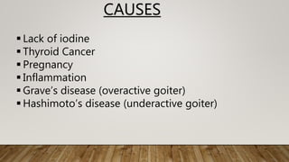 CAUSES
 Lack of iodine
 Thyroid Cancer
 Pregnancy
 Inflammation
 Grave’s disease (overactive goiter)
 Hashimoto’s disease (underactive goiter)
 