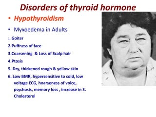• Hypothyroidism
• Myxoedema in Adults
1. Goiter
2.Puffness of face
3.Coarsening & Loss of Scalp hair
4.Ptosis
5. Dry, thickened rough & yellow skin
6. Low BMR, hypersensitive to cold, low
voltage ECG, hoarseness of voice,
psychosis, memory loss , increase in S.
Cholesterol
Disorders of thyroid hormone
 