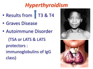 Hyperthyroidism
• Results from T3 & T4
• Graves Disease
• Autoimmune Disorder
(TSA or LATS & LATS
protectors :
immunoglobulins of IgG
class)
 