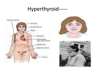 Hyperthyroid-----
 