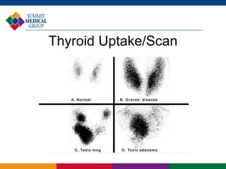 Thyroid Uptake/Scan
 