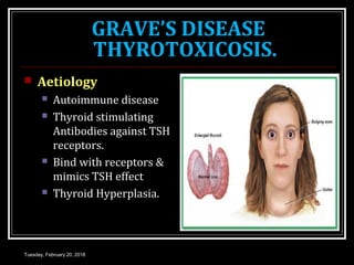 GRAVE’S DISEASE
THYROTOXICOSIS.
 Aetiology
 Autoimmune disease
 Thyroid stimulating
Antibodies against TSH
receptors.
 Bind with receptors &
mimics TSH effect
 Thyroid Hyperplasia.
Tuesday, February 20, 2018
 