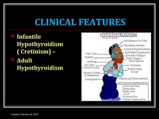 CLINICAL FEATURES
 Infantile
Hypothyroidism
( Cretinism) –
 Adult
Hypothyroidism
Tuesday, February 20, 2018
 