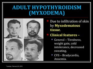 ADULT HYPOTHYROIDISM
(MYXODEMA)
 Due to infiltration of skin
by Myxodematous
tissue.
 Clinical features –
 General – Tiredness,
weight gain, cold
intolerance, decreased
sweating.
 CVS – Bradycardia,
Anaemia.
Tuesday, February 20, 2018
 