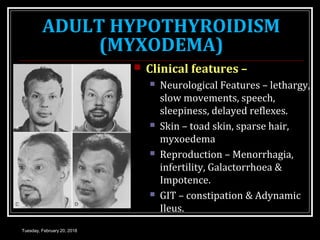 ADULT HYPOTHYROIDISM
(MYXODEMA)
 Clinical features –
 Neurological Features – lethargy,
slow movements, speech,
sleepiness, delayed reflexes.
 Skin – toad skin, sparse hair,
myxoedema
 Reproduction – Menorrhagia,
infertility, Galactorrhoea &
Impotence.
 GIT – constipation & Adynamic
Ileus.
Tuesday, February 20, 2018
 