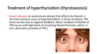 Treatment of hyperthyroidism (thyrotoxicosis)
• Grave’s disease, an autoimmune disease that affects the thyroid, is
the most common cause of hyperthyroidism. In these situations, TSH
levels are low due to negative feedback. [Note: Feedback inhibition of
TRH occurs with high levels of circulating thyroid hormone, which, in
turn, decreases secretion of TSH.]
 