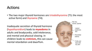 Actions
• The two major thyroid hormones are triiodothyronine (T3; the most
active form) and thyroxine (T4).
Inadequate secretion of thyroid hormone
(hypothyroidism) leads to myxedema in
adults and bradycardia, cold intolerance,
and mental and physical slowing. In
children leads to cretinism, this can cause
mental retardation and dwarfism.
 