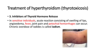 Treatment of hyperthyroidism (thyrotoxicosis)
• 3. Inhibitors of Thyroid Hormone Release
• In sensitive individuals, acute reaction consisting of swelling of lips,
angioedema, fever, joint pain and petechial hemorrhages can occur.
Chronic overdose of iodides is called iodism.
 