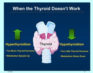 When the Thyroid Doesn’t Work DR. UMA K. Hyperthyroidism Too Much Thyroid Hormone Metabolism Speeds Up Hypothyroidism Too Little Thyroid Hormone Metabolism Slows Down 
