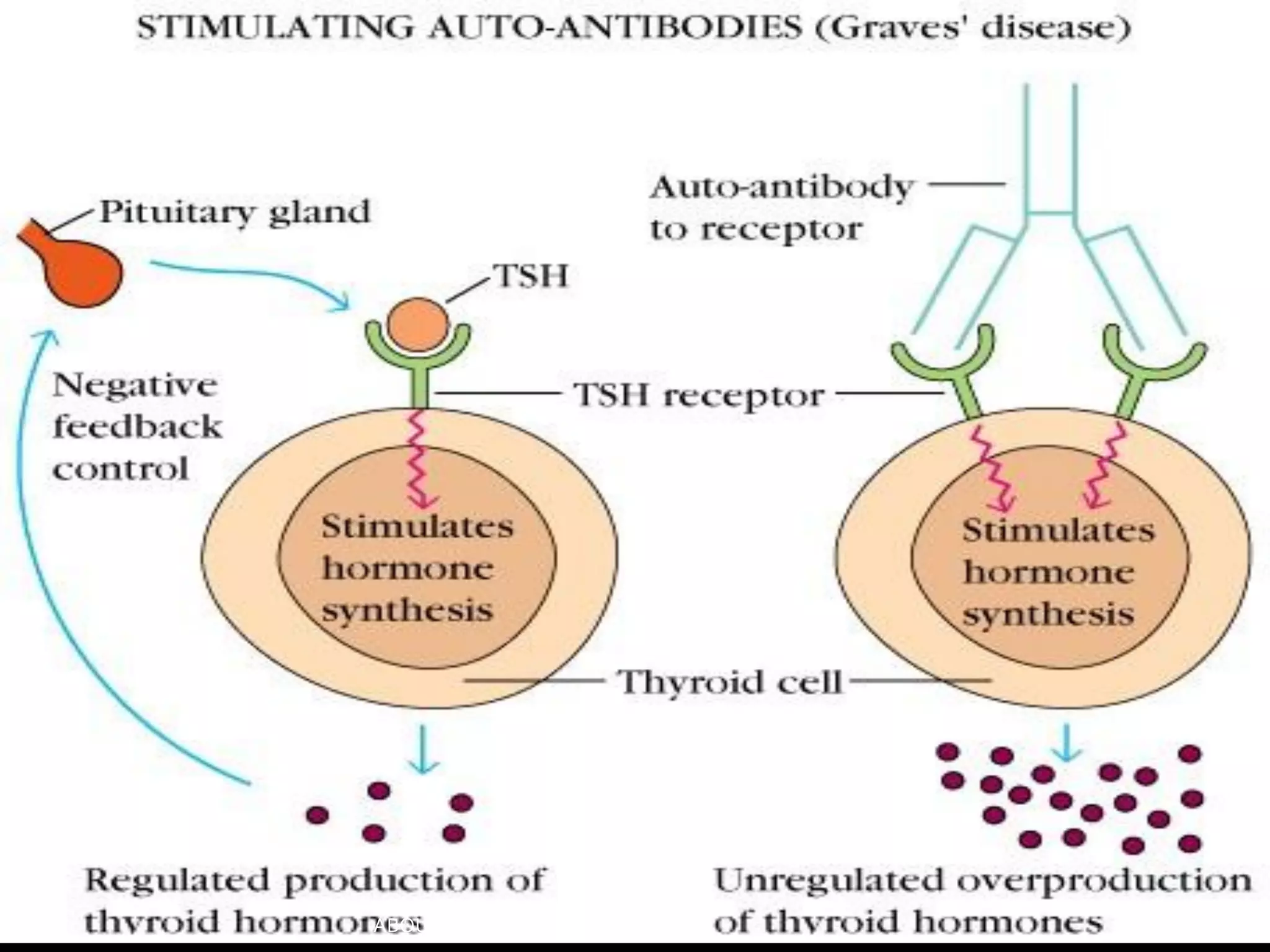 Hyperthyroidism During Pregnancy Pdf