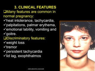 3. CLINICAL FEATURES
Many features are common in
normal pregnancy:
heat intolerance, tachycardia,
palpitations, palmar erythema,
emotional lability, vomiting and
goitre.
Discriminatory features:
weight loss
tremor
persistent tachycardia
lid lag, exophthalmos
ABOUBAKR ELNASHAR
 