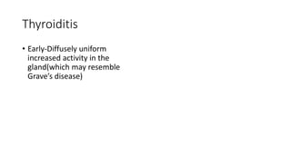 Thyroiditis
• Early-Diffusely uniform
increased activity in the
gland(which may resemble
Grave’s disease)
 