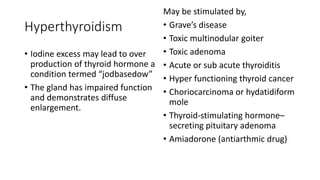 Hyperthyroidism
• Iodine excess may lead to over
production of thyroid hormone a
condition termed “jodbasedow”
• The gland has impaired function
and demonstrates diffuse
enlargement.
May be stimulated by,
• Grave’s disease
• Toxic multinodular goiter
• Toxic adenoma
• Acute or sub acute thyroiditis
• Hyper functioning thyroid cancer
• Choriocarcinoma or hydatidiform
mole
• Thyroid-stimulating hormone–
secreting pituitary adenoma
• Amiadorone (antiarthmic drug)
 