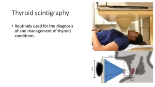 Thyroid scintigraphy
• Routinely used for the diagnosis
of and management of thyroid
conditions
 