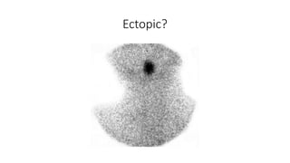 Ectopic?
 