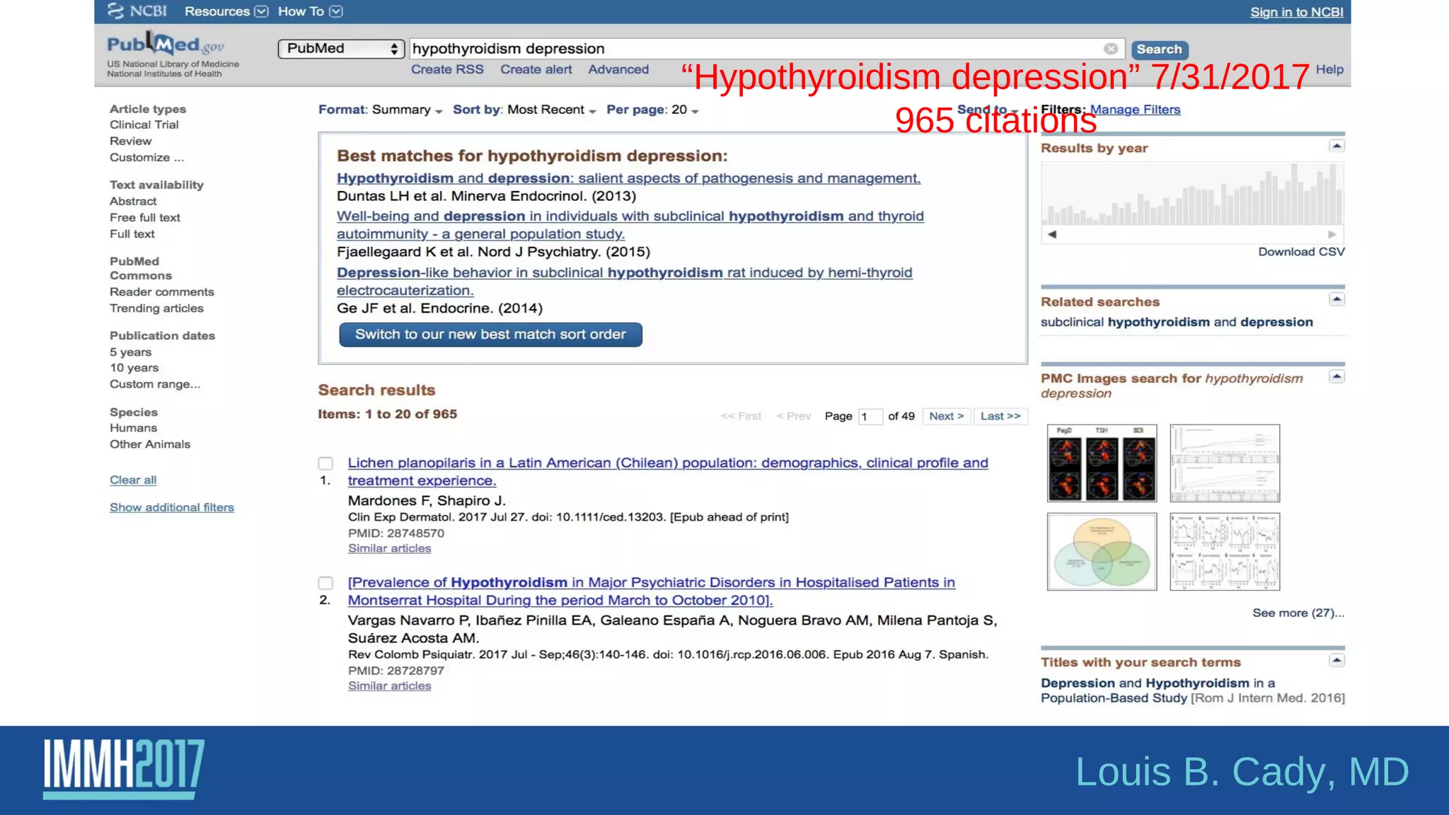 “Hypothyroidism depression” 7/31/2017
965 citations
Louis B. Cady, MD
 