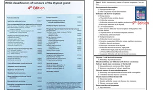 4th Edition
5th Edition
 