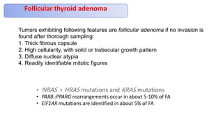 Follicular thyroid adenoma
• NRAS > HRAS mutations and KRAS mutations
• PAX8::PPARG rearrangements occur in about 5-10% of FA
• EIF1AX mutations are identified in about 5% of FA
Tumors exhibiting following features are follicular adenoma if no invasion is
found after thorough sampling:
1. Thick fibrous capsule
2. High cellularity, with solid or trabecular growth pattern
3. Diffuse nuclear atypia
4. Readily identifiable mitotic figures
 