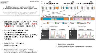 • overexpression of the
3′ portions of the GLIS
genes, which induces
• Upregulation of
extracellular
matrix-related genes
including collagen
genes
• PAX-8: GLIS3,
PAX8:GLIS1
• The intratrabecular eosinophilic hyaline
material is negative with the Congo red stain.
• Lobectomy is curative
• Lymph node or distant metastasis in rare cases
 