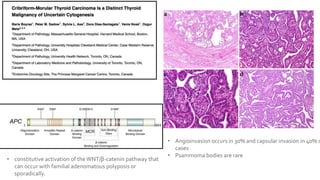 • constitutive activation of theWNT/β-catenin pathway that
can occur with familial adenomatous polyposis or
sporadically.
• Angioinvasion occurs in 30% and capsular invasion in 40% o
cases
• Psammoma bodies are rare
 