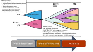 Well differentiated Poorly differentiated Anaplastic
 