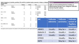 IHC Follicular
adenoma
Follicular
carcinoma
Follicular
variant of
Papillary
carcinoma
HBME1 Usually - May be + Usually +
Galectin 3 Usually - Usually + Usually +
CK19 Usually - Usually - Usually +
CITED3 - Usually - May be +
IMP3 - May be + May be +
 