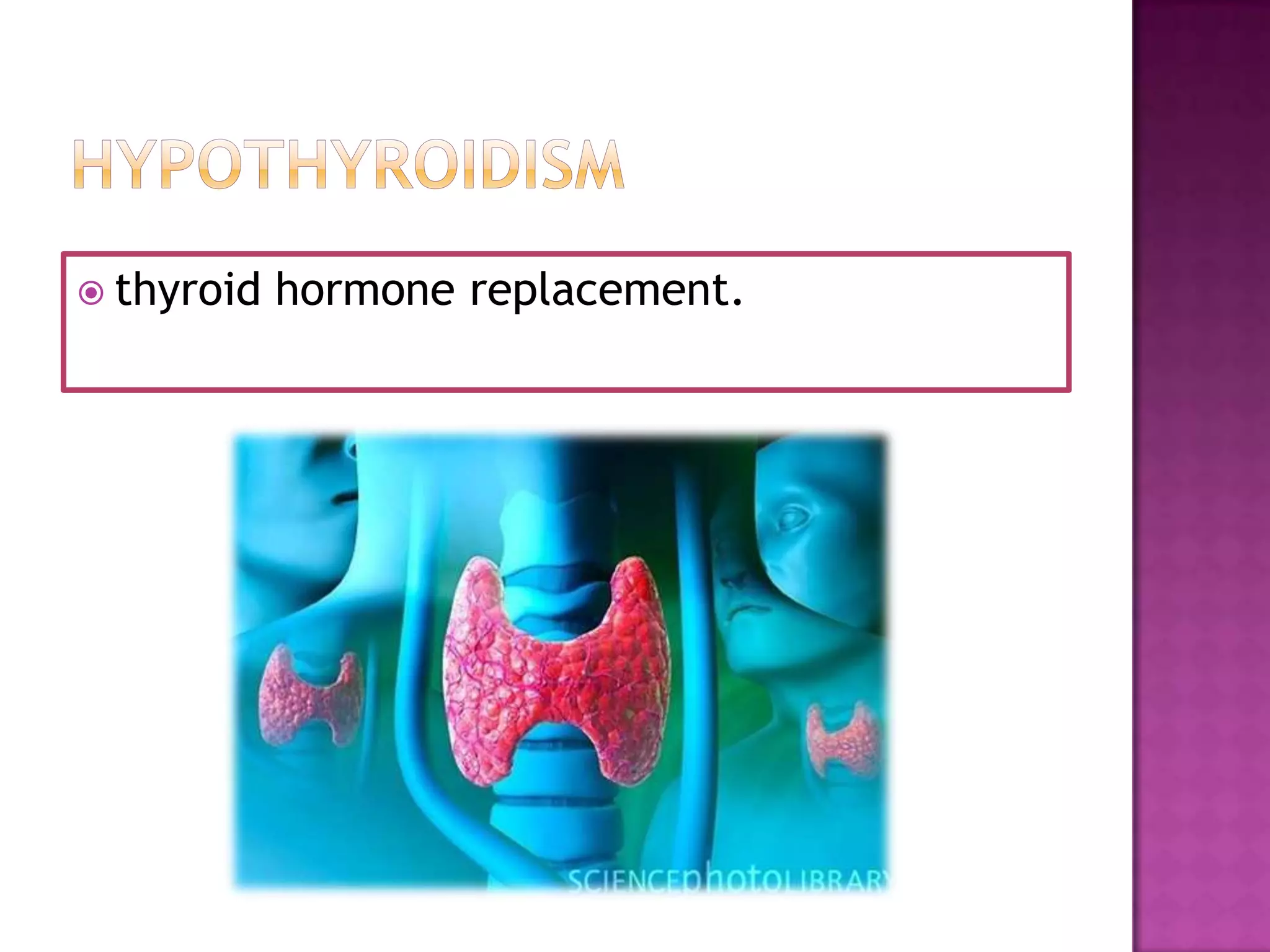  thyroid

hormone replacement.

 