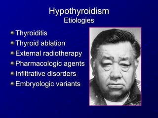 Hypothyroidism
Hypothyroidism
Etiologies
Etiologies
Thyroiditis
Thyroiditis
Thyroid ablation
Thyroid ablation
External radiotherapy
External radiotherapy
Pharmacologic agents
Pharmacologic agents
Infiltrative disorders
Infiltrative disorders
Embryologic variants
Embryologic variants
 