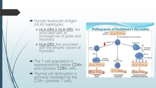  Human leukocyte antigen
(HLA) haplotypes:
 HLA-DR4 & HLA-DR5: Are
associated with an
increased risk of goiter and
thyroiditis.
 HLA-DR3: Are associated
with the atrophic variant of
thyroiditis.
 The T-cell population is
represented by helper CD4+
and cytotoxic CD8+ cells.
 Thyroid cell destruction is
primarily mediated by the
CD8+ cytotoxic T cells.
 