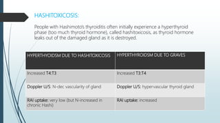 HYPERTHYROIDSM DUE TO GRAVES
Increased T4:T3 Increased T3:T4
Doppler U/S: N-dec vascularity of gland Doppler U/S: hypervascular thyroid gland
RAI uptake: very low (but N-increased in
chronic Hashi)
RAI uptake: increased
HASHITOXICOSIS:
People with Hashimoto's thyroiditis often initially experience a hyperthyroid
phase (too much thyroid hormone), called hashitoxicosis, as thyroid hormone
leaks out of the damaged gland as it is destroyed.
HYPERTHYOIDSM DUE TO HASHITOXICOSIS
 