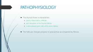 PATHOPHYSIOLOGY
 The thyroid shows a characteristic
 patchy inflammatory infiltrate
 with disruption of the thyroid follicles
 multinucleated giant cells within some follicles.
 The follicular changes progress to granulomas accompanied by fibrosis.
 