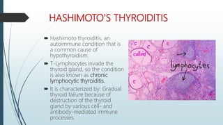HASHIMOTO'S THYROIDITIS
 Hashimoto thyroiditis, an
autoimmune condition that is
a common cause of
hypothyroidism.
 T-Lymphocytes invade the
thyroid gland, so the condition
is also known as chronic
lymphocytic thyroiditis.
 It is characterized by: Gradual
thyroid failure because of
destruction of the thyroid
gland by various cell- and
antibody-mediated immune
processes.
 
