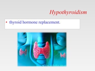 Hypothyroidism
• thyroid hormone replacement.
 
