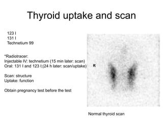 Thyroid uptake and scan
123 I
131 I
Technetium 99
Normal thyroid scan
*Radiotracer:
Injectable IV: technetium (15 min later: scan)
Oral: 131 I and 123 I;(24 h later: scan/uptake)
Scan: structure
Uptake: function
Obtain pregnancy test before the test
 