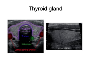 Thyroid gland
 