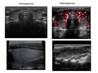 Homogenous Heterogenous
 