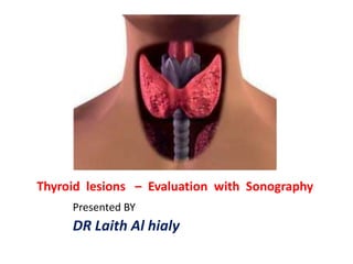 Thyroid lesions – Evaluation with Sonography
Presented BY

DR Laith Al hialy

 